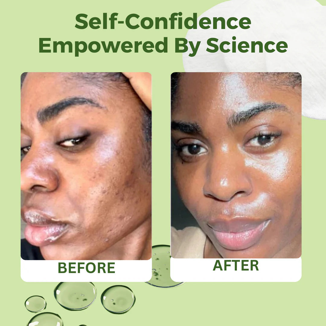 Anti-Aging, Dark Spots, and Wrinkle Minimizing Snail Mucin Toner Pad